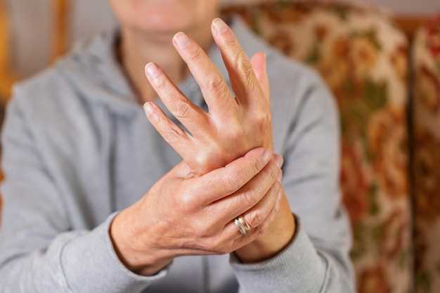 Медикаментозное лечение остеоартроза межфаланговых суставов кистей рук 2 степени